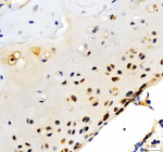 Immunohistochemical staining of Collagen Type II/COL2A1 using anti-COL2A1 antibody. Collagen Type II/COL2A1 was detected in a paraffin-embedded section of rat knee cartilage tissue. Heat mediated antigen retrieval was performed in EDTA buffer (pH 8.0, epitope retrieval solution). The tissue section was blocked with 10% goat serum. The tissue section was then incubated with 2 ug/ml rabbit anti-COL2A1 antibody overnight at 4oC. Peroxidase Conjugated Goat Anti-rabbit IgG was used as secondary antibody and incubated for 30 minutes at 37oC. The tissue section was developed using an HRP secondary and DAB substrate.