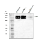 Western blot analysis of Collagen Type II/COL2A1 using anti-COL2A1 antibody. Lane 1: rat bone tissue lysates(100oC boiled for 5 minutes), Lane 2: rat bone tissue lysates(37oC incubated for 10 minutes), Lane 3: mouse bone tissue lysates(100oC boiled for 5 minutes). After electrophoresis, proteins were transferred to a nitrocellulose membrane at 150 mA for 50-90 minutes. Blocked the membrane with 5% non-fat milk/TBS for 1.5 hour at RT. The membrane was incubated with rabbit anti-COL2A1 antibody at 0.5 ug/ml overnight at 4oC, then washed with TBS-0.1%Tween 3 times with 5 minutes each and probed with a goat anti-rabbit IgG-HRP secondary antibody at a dilution of 1:5000 for 1.5 hour at RT. The signal was developed using enhanced chemiluminescent. Western blot analysis of COL2A1 in rat and mouse bone extracts using an anti COL2A1 antibody under different sample heating conditions. A predominant doublet is detected at an approximately 150 kDa in all bone lysates, running above the predicted ~142 kDa size but consistent with the reported migration of procollagen type II alpha1 chains that retain N and C propeptides and post translational modifications. Additional weaker bands above and below the major doublet likely reflect crosslinked or partially denatured collagen II species and limited degradation fragments rather than distinct alternative isoforms.