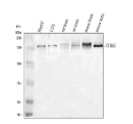 Western blot analysis of TTBK1 using anti-TTBK1 antibody. Electrophoresis was performed on a 8% SDS-PAGE gel at 80V (Stacking gel) / 120V (Resolving gel) for 2 hours. Lane 1: human HepG2 whole cell lysates, Lane 2: human U251 whole cell lysates, Lane 3: rat brain tissue lysates, Lane 4: rat testis tissue lysates, Lane 5: mouse brain tissue lysates, Lane 6: mouse testis tissue lysates. After electrophoresis, proteins were transferred to a nitrocellulose membrane at 150 mA for 50-90 minutes. Blocked the membrane with 5% non-fat milk/TBS for 1.5 hour at RT. The membrane was incubated with rabbit anti-TTBK1 antibody at 0.5 ug/ml overnight at 4oC, then washed with TBS-0.1%Tween 3 times with 5 minutes each and probed with a goat anti-rabbit IgG-HRP secondary antibody at a dilution of 1:5000 for 1.5 hour at RT. The signal was developed using an ECL Plus Western Blotting Substrate. A specific band was detected for TTBK1 at approximately 153 kDa. The expected molecular weight of TTBK1 is ~143 kDa.