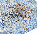 Immunohistochemical staining of ENTPD5 using anti-ENTPD5 antibody. ENTPD5 was detected in a paraffin-embedded section of mouse adrenal tissue. Heat mediated antigen retrieval was performed in EDTA buffer (pH 8.0, epitope retrieval solution). The tissue section was blocked with 10% goat serum. The tissue section was then incubated with 2 ug/ml rabbit anti-ENTPD5 antibody overnight at 4oC. Peroxidase Conjugated Goat Anti-rabbit IgG was used as secondary antibody and incubated for 30 minutes at 37oC. The tissue section was developed using an HRP secondary and DAB substrate.