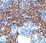 Immunohistochemical staining of ENTPD5 using anti-ENTPD5 antibody. ENTPD5 was detected in a paraffin-embedded section of mouse kidney tissue. Heat mediated antigen retrieval was performed in EDTA buffer (pH 8.0, epitope retrieval solution). The tissue section was blocked with 10% goat serum. The tissue section was then incubated with 2 ug/ml rabbit anti-ENTPD5 antibody overnight at 4oC. Peroxidase Conjugated Goat Anti-rabbit IgG was used as secondary antibody and incubated for 30 minutes at 37oC. The tissue section was developed using an HRP secondary and DAB substrate.