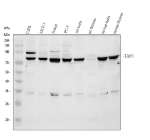 Western blot analysis of TAF6 using anti-TAF6 antibody. Electrophoresis was performed on a 10% SDS-PAGE gel at 80V (Stacking gel) / 120V (Resolving gel) for 2 hours. Lane 1: human U2OS whole cell lysates, Lane 2: human MCF-7 whole cell lysates, Lane 3: human Jurkat whole cell lysates, Lane 4: human PC-3 whole cell lysates, Lane 5: rat testis tissue lysates, Lane 6: rat thymus tissue lysates, Lane 7: mouse testis tissue lysates, Lane 8: mouse thymus tissue lysates. After electrophoresis, proteins were transferred to a nitrocellulose membrane at 150 mA for 50-90 minutes. Blocked the membrane with 5% non-fat milk/TBS for 1.5 hour at RT. The membrane was incubated with rabbit anti-TAF6 antibody at 0.5 ug/ml overnight at 4oC, then washed with TBS-0.1%Tween 3 times with 5 minutes each and probed with a goat anti-rabbit IgG-HRP secondary antibody at a dilution of 1:5000 for 1.5 hour at RT. The signal was developed using an ECL Plus Western Blotting Substrate. A specific band was detected for TAF6 at approximately 73 kDa. The expected molecular weight of TAF6 is ~73 kDa.