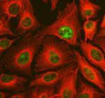 Immunofluorescent staining of TAF6 using anti-TAF6 antibody (green) and anti-Beta Tubulin antibody (red). TAF6 was detected in an immunocytochemical section of U2OS cells. Enzyme antigen retrieval was performed using IHC enzyme antigen retrieval reagent for 15 mins. The cells were blocked with 10% goat serum. And then incubated with 5 ug/ml rabbit anti-TAF6 antibody and mouse anti-Beta Tubulin antibody overnight at 4oC. DyLight 488 Conjugated Goat Anti-Rabbit IgG and Cy3 Conjugated Goat Anti-Mouse IgG were used as secondary antibody at 1:500 dilution and incubated for 30 minutes at 37oC. Visualize using a fluorescence microscope and filter sets appropriate for the label used.
