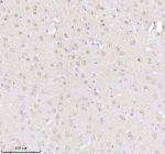 Immunohistochemical staining of MECP2 using anti-MECP2 antibody. MECP2 was detected in a paraffin-embedded section of mouse brain tissue. Heat mediated antigen retrieval was performed in EDTA buffer (pH 8.0, epitope retrieval solution). The tissue section was blocked with 10% goat serum. The tissue section was then incubated with 2 ug/ml rabbit anti-MECP2 antibody overnight at 4oC. Peroxidase Conjugated Goat Anti-rabbit IgG was used as secondary antibody and incubated for 30 minutes at 37oC. The tissue section was developed using an HRP secondary and DAB substrate.