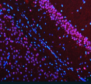 Immunofluorescent staining of MECP2 using anti-MECP2 antibody (red). MECP2 was detected in a paraffin-embedded section of mouse brain tissue. Heat mediated antigen retrieval was performed in EDTA buffer (pH 8.0, epitope retrieval solution). The tissue section was blocked with 10% goat serum. The tissue section was then incubated with 5 ug/ml rabbit anti-MECP2 antibody overnight at 4oC. Cy3 Conjugated Goat Anti-Rabbit IgG was used as secondary antibody at 1:500 dilution and incubated for 30 minutes at 37oC. The section was counterstained with DAPI nuclear stain (blue). Visualize using a fluorescence microscope and filter sets appropriate for the label used.