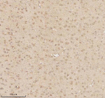 Immunohistochemical staining of MECP2 using anti-MECP2 antibody. MECP2 was detected in a paraffin-embedded section of rat brain tissue. Heat mediated antigen retrieval was performed in EDTA buffer (pH 8.0, epitope retrieval solution). The tissue section was blocked with 10% goat serum. The tissue section was then incubated with 2 ug/ml rabbit anti-MECP2 antibody overnight at 4oC. Peroxidase Conjugated Goat Anti-rabbit IgG was used as secondary antibody and incubated for 30 minutes at 37oC. The tissue section was developed using an HRP secondary and DAB substrate.
