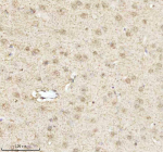Immunohistochemical staining of MECP2 using anti-MECP2 antibody. MECP2 was detected in a paraffin-embedded section of rat brain tissue. Heat mediated antigen retrieval was performed in EDTA buffer (pH 8.0, epitope retrieval solution). The tissue section was blocked with 10% goat serum. The tissue section was then incubated with 2 ug/ml rabbit anti-MECP2 antibody overnight at 4oC. Peroxidase Conjugated Goat Anti-rabbit IgG was used as secondary antibody and incubated for 30 minutes at 37oC. The tissue section was developed using an HRP secondary and DAB substrate.