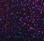 Immunofluorescent staining of MECP2 using anti-MECP2 antibody. MECP2 was detected in a paraffin-embedded section of rat brain tissue. Heat mediated antigen retrieval was performed in EDTA buffer (pH 8.0, epitope retrieval solution). The tissue section was blocked with 10% goat serum. The tissue section was then incubated with 5 ug/ml rabbit anti-MECP2 antibody overnight at 4oC. Cy3 Conjugated Goat Anti-Rabbit IgG was used as secondary antibody at 1:500 dilution and incubated for 30 minutes at 37oC. The section was counterstained with DAPI nuclear stain (blue). Visualize using a fluorescence microscope and filter sets appropriate for the label used.