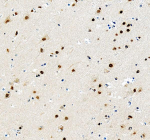Immunohistochemical staining of MECP2 using anti-MECP2 antibody. MECP2 was detected in a paraffin-embedded section of human brain tissue. Heat mediated antigen retrieval was performed in EDTA buffer (pH 8.0, epitope retrieval solution). The tissue section was blocked with 10% goat serum. The tissue section was then incubated with 2 ug/ml rabbit anti-MECP2 antibody overnight at 4oC. Peroxidase Conjugated Goat Anti-rabbit IgG was used as secondary antibody and incubated for 30 minutes at 37oC. The tissue section was developed using an HRP secondary and DAB substrate.