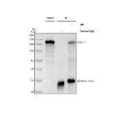 Immunoprecipitation of SCAF11 protein from 500ug of human HeLa whole cell lysate with 2ug of SCAF11 antibody.