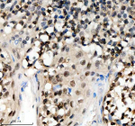 Immunohistochemical staining of SCAF11 using anti-SCAF11 antibody. SCAF11 was detected in a paraffin-embedded section of human tonsil tissue. Heat mediated antigen retrieval was performed in EDTA buffer (pH 8.0, epitope retrieval solution). The tissue section was blocked with 10% goat serum. The tissue section was then incubated with 2 ug/ml rabbit anti-SCAF11 antibody overnight at 4oC. Peroxidase Conjugated Goat Anti-rabbit IgG was used as secondary antibody and incubated for 30 minutes at 37oC. The tissue section was developed using an HRP secondary and DAB substrate.