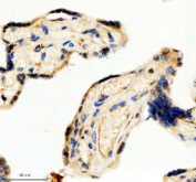 Immunohistochemical staining of SCAF11 using anti-SCAF11 antibody. SCAF11 was detected in a paraffin-embedded section of human placenta tissue. Heat mediated antigen retrieval was performed in EDTA buffer (pH 8.0, epitope retrieval solution). The tissue section was blocked with 10% goat serum. The tissue section was then incubated with 2 ug/ml rabbit anti-SCAF11 antibody overnight at 4oC. Peroxidase Conjugated Goat Anti-rabbit IgG was used as secondary antibody and incubated for 30 minutes at 37oC. The tissue section was developed using an HRP secondary and DAB substrate.