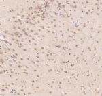 Immunohistochemical staining of TDP1 using anti-TDP1 antibody. TDP1 was detected in a paraffin-embedded section of rat brain tissue. Heat mediated antigen retrieval was performed in EDTA buffer (pH 8.0, epitope retrieval solution). The tissue section was blocked with 10% goat serum. The tissue section was then incubated with 2 ug/ml rabbit anti-TDP1 antibody overnight at 4oC. Peroxidase Conjugated Goat Anti-rabbit IgG was used as secondary antibody and incubated for 30 minutes at 37oC. The tissue section was developed using an HRP secondary and DAB substrate.