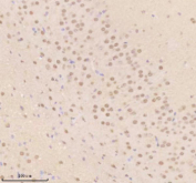 Immunohistochemical staining of TDP1 using anti-TDP1 antibody. TDP1 was detected in a paraffin-embedded section of mouse brain tissue. Heat mediated antigen retrieval was performed in EDTA buffer (pH 8.0, epitope retrieval solution). The tissue section was blocked with 10% goat serum. The tissue section was then incubated with 2 ug/ml rabbit anti-TDP1 antibody overnight at 4oC. Peroxidase Conjugated Goat Anti-rabbit IgG was used as secondary antibody and incubated for 30 minutes at 37oC. The tissue section was developed using an HRP secondary and DAB substrate.
