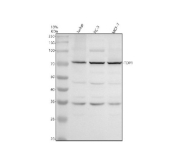 Western blot analysis of TDP1 using anti-TDP1 antibody. Electrophoresis was performed on a 10% SDS-PAGE gel at 80V (Stacking gel) / 120V (Resolving gel) for 2 hours. Lane 1: human Jurkat whole cell lysates, Lane 2: human PC-3 whole cell lysates, Lane 3: human MCF-7 whole cell lysates. After electrophoresis, proteins were transferred to a nitrocellulose membrane at 150 mA for 50-90 minutes. Blocked the membrane with 5% non-fat milk/TBS for 1.5 hour at RT. The membrane was incubated with rabbit anti-TDP1 antibody at 0.5 ug/ml overnight at 4oC, then washed with TBS-0.1%Tween 3 times with 5 minutes each and probed with a goat anti-rabbit IgG-HRP secondary antibody at a dilution of 1:5000 for 1.5 hour at RT. The signal was developed using an ECL Plus Western Blotting Substrate. The expected molecular weight of TDP1 is ~68 kDa.