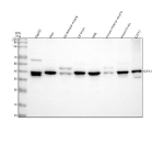Western blot analysis of GIPC1 using anti-GIPC1 antibody. Lane 1: human HepG2 whole cell lysates, Lane 2: human Hela whole cell lysates, Lane 3: rat skeletal muscle tissue lysates, Lane 4: rat brain tissue lysates, Lane 5: rat NRK whole cell lysates, Lane 6: mouse skeletal muscle tissue lysates, Lane 7: mouse brain tissue lysates, Lane 8: mouse C2C12 whole cell lysates. After electrophoresis, proteins were transferred to a nitrocellulose membrane at 150 mA for 50-90 minutes. Blocked the membrane with 5% non-fat milk/TBS for 1.5 hour at RT. The membrane was incubated with rabbit anti-GIPC1 antibody at 0.25 ug/ml overnight at 4oC, then washed with TBS-0.1%Tween 3 times with 5 minutes each and probed with a goat anti-rabbit IgG-HRP secondary antibody at a dilution of 1:5000 for 1.5 hour at RT. The signal was developed using enhanced chemiluminescent. A predominant band is detected at an approximately 40 kDa in all samples, running slightly above the predicted ~36 kDa size but consistent with the reported apparent molecular weight of endogenous GIPC1. HepG2 lysate shows a closely spaced doublet, likely reflecting differential phosphorylation or processing, and rodent skeletal muscle displays an additional ~45 kDa band consistent with muscle-specific post translationally modified GIPC1 species rather than alternative isoforms.