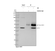 Immunoprecipitation of GIPC1 protein from 500ug of human A431 whole cell lysate with 2ug of GIPC1 antibody.
