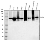 Western blot analysis of SMTN using anti-SMTN antibody. Lane 1: human Colo320 whole cell lysates, Lane 2: human PC-3 whole cell lysates, Lane 3: human U20S whole cell lysates, Lane 4: human 293T whole cell lysates, Lane 5: rat stomach tissue lysates, Lane 6: rat heart tissue lysates, Lane 7: mouse stomach tissue lysates, Lane 8: mouse heart tissue lysates. After electrophoresis, proteins were transferred to a nitrocellulose membrane at 150 mA for 50-90 minutes. Blocked the membrane with 5% non-fat milk/TBS for 1.5 hour at RT. The membrane was incubated with rabbit anti-SMTN antibody at 0.25 ug/ml overnight at 4oC, then washed with TBS-0.1%Tween 3 times with 5 minutes each and probed with a goat anti-rabbit IgG-HRP secondary antibody at a dilution of 1:5000 for 1.5 hour at RT. The signal was developed using enhanced chemiluminescent. Predicted molecular weight ~99 kDa but commonly observed at ~110 kDa (long form).