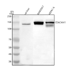 Western blot analysis of CEACAM1 using anti-Ceacam1 antibody. Lane 1: rat liver tissue lysates, Lane 2: mouse Raw264.7 whole cell lysates, Lane 3: mouse Hepa1-6 whole cell lysates. After electrophoresis, proteins were transferred to a nitrocellulose membrane at 150 mA for 50-90 minutes. Blocked the membrane with 5% non-fat milk/TBS for 1.5 hour at RT. The membrane was incubated with rabbit anti-Ceacam1 antibody at 0.5 ug/ml overnight at 4oC, then washed with TBS-0.1%Tween 3 times with 5 minutes each and probed with a goat anti-rabbit IgG-HRP secondary antibody at a dilution of 1:5000 for 1.5 hour at RT. The signal was developed using enhanced chemiluminescent. A predominant doublet is detected between an approximately 140 and 150 kDa in all samples, running well above the predicted ~57 kDa polypeptide mass. The higher apparent molecular weight is consistent with heavily N-glycosylated CEACAM1, and the 140-150 kDa doublet likely represents disulfide-linked dimers of mature CEACAM1 present in two closely spaced glycoforms.