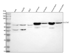 Western blot analysis of SLC7A7 using anti-SLC7A7 antibody. Lane 1: human Hela whole cell lysates, Lane 2: human HepG2 whole cell lysates, Lane 3: human 293T whole cell lysates, Lane 4: rat heart tissue lysates, Lane 5: rat brain tissue lysates, Lane 6: mouse heart tissue lysates, Lane 7: mouse brain tissue lysates. After electrophoresis, proteins were transferred to a nitrocellulose membrane at 150 mA for 50-90 minutes. Blocked the membrane with 5% non-fat milk/TBS for 1.5 hour at RT. The membrane was incubated with rabbit anti-SLC7A7 antibody at 0.5 ug/ml overnight at 4oC, then washed with TBS-0.1%Tween 3 times with 5 minutes each and probed with a goat anti-rabbit IgG-HRP secondary antibody at a dilution of 1:5000 for 1.5 hour at RT. The signal was developed using enhanced chemiluminescent. Predominant bands are detected at an approximately 65 kDa in human cell lines and ~70 kDa in mouse and rat tissues, running above the predicted ~56 kDa mass but consistent with the higher apparent molecular weight typical of glycosylated multi pass amino acid transporters. A weaker band between roughly 40 and 50 kDa is present in several samples and likely represents a truncated or differentially processed form of SLC7A7, or less likely cross reactive signal from a related transporter.