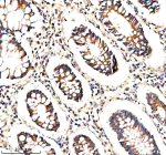 Immunohistochemical staining of STXBP3 using anti-STXBP3 antibody. STXBP3 was detected in a paraffin-embedded section of human colon tissue. Heat mediated antigen retrieval was performed in EDTA buffer (pH 8.0, epitope retrieval solution). The tissue section was blocked with 10% goat serum. The tissue section was then incubated with 2 ug/ml rabbit anti-STXBP3 antibody overnight at 4oC. Peroxidase Conjugated Goat Anti-rabbit IgG was used as secondary antibody and incubated for 30 minutes at 37oC. The tissue section was developed using an HRP secondary and DAB substrate.
