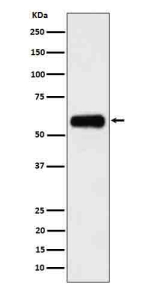 Western blot analysis of CD116 in human 293 cell lysate using CD116 antibody. A predominant band is detected at an approximately 55-60 kDa, running above the predicted ~46-47 kDa size but consistent with the higher apparent molecular weight reported for the heavily N glycosylated receptor.