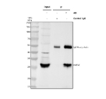 Immunoprecipitating IMPA1 in Jurkat whole cell lysate. Western blot analysis of IMPA1 using anti-IMPA1 antibody. Lane 1: Jurkat whole cell lysates (30ug), Lane 2: Rabbit control IgG instead of anti-IMPA1 antibody in Jurkat whole cell lysate, Lane 3: anti-IMPA1 antibody (2ug) + Jurkat whole cell lysate (500ug). After electrophoresis, proteins were transferred to a membrane. Then the membrane was incubated with rabbit anti-IMPA1 antibody at a dilution of 0.5 ug/ml and probed with a goat anti-rabbit IgG-HRP secondary antibody. The signal is developed using ECL Plus Western Blotting Substrate. A specific band was detected for IMPA1 at approximately 30 kDa. The expected molecular weight of IMPA1 is ~30 kDa.