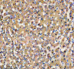 Immunohistochemical staining of TRIM40 using anti-TRIM40 antibody. TRIM40 was detected in a paraffin-embedded section of human liver tissue. Heat mediated antigen retrieval was performed in EDTA buffer (pH 8.0, epitope retrieval solution). The tissue section was blocked with 10% goat serum. The tissue section was then incubated with 2 ug/ml rabbit anti-TRIM40 antibody overnight at 4oC. Peroxidase Conjugated Goat Anti-rabbit IgG was used as secondary antibody and incubated for 30 minutes at 37oC. The tissue section was developed using an HRP secondary and DAB substrate.