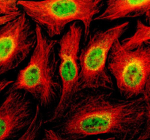 Immunofluorescent staining of TBKBP1 using anti-TBKBP1 antibody (green) and anti-Beta Tubulin antibody (red). TBKBP1 was detected in an immunocytochemical section of U2OS cells. Enzyme antigen retrieval was performed using IHC enzyme antigen retrieval reagent for 15 mins. The cells were blocked with 10% goat serum. And then incubated with 5 ug/ml rabbit anti-TBKBP1 antibody and mouse anti-Beta Tubulin antibody overnight at 4oC. DyLight 488 Conjugated Goat Anti-Rabbit IgG and Cy3 Conjugated Goat Anti-Mouse IgG were used as secondary antibody at 1:500 dilution and incubated for 30 minutes at 37oC. Visualize using a fluorescence microscope and filter sets appropriate for the label used.