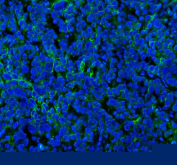 Immunohistochemical staining of SPA17 using anti-SPA17 antibody (green). SPA17 was detected in a paraffin-embedded section of human placenta tissue. Heat mediated antigen retrieval was performed in EDTA buffer (pH 8.0, epitope retrieval solution). The tissue section was blocked with 10% goat serum. The tissue section was then incubated with 2 ug/ml rabbit anti-SPA17 antibody overnight at 4oC. Peroxidase Conjugated Goat Anti-rabbit IgG was used as secondary antibody and incubated for 30 minutes at 37oC. The tissue section was developed using an HRP secondary and DAB substrate.