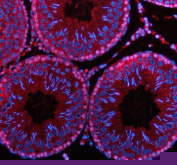 Immunofluorescent staining of PDZD8 using anti-PDZD8 antibody (red). PDZD8 was detected in a paraffin-embedded section of rat testis tissue. Heat mediated antigen retrieval was performed in EDTA buffer (pH 8.0, epitope retrieval solution). The tissue section was blocked with 10% goat serum. The tissue section was then incubated with 5 ug/ml rabbit anti-PDZD8 antibody overnight at 4oC. Cy3 Conjugated Goat Anti-Rabbit IgG was used as secondary antibody at 1:500 dilution and incubated for 30 minutes at 37oC. The section was counterstained with DAPI nuclear stain (blue). Visualize using a fluorescence microscope and filter sets appropriate for the label used.