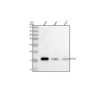 Western blot analysis of MYL6 using anti-MYL6 antibody. Lane 1: human SiHa whole cell lysates, Lane 2: human Hela whole cell lysates, Lane 3: human THP-1 whole cell lysates. After electrophoresis, proteins were transferred to a nitrocellulose membrane at 150 mA for 50-90 minutes. Blocked the membrane with 5% non-fat milk/TBS for 1.5 hour at RT. The membrane was incubated with rabbit anti-MYL6 antibody at 0.5 ug/ml overnight at 4oC, then washed with TBS-0.1%Tween 3 times with 5 minutes each and probed with a goat anti-rabbit IgG-HRP secondary antibody at a dilution of 1:5000 for 1.5 hour at RT. The signal was developed using enhanced chemiluminescent. A specific band was detected for MYL6 at approximately 16 kDa. The expected molecular weight of MYL6 is ~16 kDa.