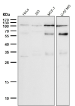 Western blot testing of human samples using the Phospho-Rb (Ser780) antibody at 1:1000 dilution for 1 hour at room temperature. Predicted molecular weight ~106 kDa.