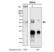All lanes use the antibody at 1:5K dilution for 1 hour at room temperature.