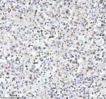 Immunohistochemical staining of MED4 using anti-MED4 antibody. MED4 was detected in a paraffin-embedded section of human testicular seminoma tissue. Heat mediated antigen retrieval was performed in EDTA buffer (pH 8.0, epitope retrieval solution). The tissue section was blocked with 10% goat serum. The tissue section was then incubated with 2 ug/ml rabbit anti-MED4 antibody overnight at 4oC. Peroxidase Conjugated Goat Anti-rabbit IgG was used as secondary antibody and incubated for 30 minutes at 37oC. The tissue section was developed using an HRP secondary and DAB substrate.