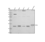 Western blot analysis of NME3 using anti-NME3 antibody. Electrophoresis was performed on a 12% SDS-PAGE gel at 80V (Stacking gel) / 120V (Resolving gel) for 2 hours. Lane 1: human 293T whole cell lysates, Lane 2: human SIHA whole cell lysates, Lane 3: human MCF-7 whole cell lysates, Lane 4: human THP-1 whole cell lysates, Lane 5: rat kidney tissue lysates. After electrophoresis, proteins were transferred to a nitrocellulose membrane at 150 mA for 50-90 minutes. Blocked the membrane with 5% non-fat milk/TBS for 1.5 hour at RT. The membrane was incubated with rabbit anti-NME3 antibody at 0.5 ug/ml overnight at 4oC, then washed with TBS-0.1%Tween 3 times with 5 minutes each and probed with a goat anti-rabbit IgG-HRP secondary antibody at a dilution of 1:5000 for 1.5 hour at RT. The signal was developed using an ECL Plus Western Blotting Substrate. A predominant band is detected at an approximately 17 kDa in human cell lines, slightly below the predicted ~19 kDa size and consistent with the processed mature form of NME3. SiHa and THP-1 lysates also show a weaker band near 18 kDa, likely representing a partially processed or differently modified NME3 species. Rat kidney displays a band close to 19 kDa, consistent with species specific differences in processing or migration.