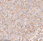 Immunohistochemical staining of COQ8B using anti-COQ8B antibody. COQ8B was detected in a paraffin-embedded section of human testicular seminoma tissue. Heat mediated antigen retrieval was performed in EDTA buffer (pH 8.0, epitope retrieval solution). The tissue section was blocked with 10% goat serum. The tissue section was then incubated with 2 ug/ml rabbit anti-COQ8B antibody overnight at 4oC. Peroxidase Conjugated Goat Anti-rabbit IgG was used as secondary antibody and incubated for 30 minutes at 37oC. The tissue section was developed using an HRP secondary and DAB substrate.