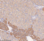 Immunohistochemical staining of COQ8B using anti-COQ8B antibody. COQ8B was detected in a paraffin-embedded section of mouse ovary tissue. Heat mediated antigen retrieval was performed in EDTA buffer (pH 8.0, epitope retrieval solution). The tissue section was blocked with 10% goat serum. The tissue section was then incubated with 2 ug/ml rabbit anti-COQ8B antibody overnight at 4oC. Peroxidase Conjugated Goat Anti-rabbit IgG was used as secondary antibody and incubated for 30 minutes at 37oC. The tissue section was developed using an HRP secondary and DAB substrate.