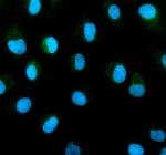 Immunofluorescent staining of TIMM50 using anti-TIMM50 antibody (green). TIMM50 was detected in an immunocytochemical section of cells. Enzyme antigen retrieval was performed using IHC enzyme antigen retrieval reagent for 15 mins. The cells were blocked with 10% goat serum. And then incubated with 5 ug/ml rabbit anti-TIMM50 antibody overnight at 4oC. DyLight 488 Conjugated Goat Anti-Rabbit IgG was used as secondary antibody at 1:500 dilution and incubated for 30 minutes at 37oC. Visualize using a fluorescence microscope and filter sets appropriate for the label used.