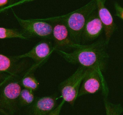 Immunofluorescent staining of RGL3 using anti-RGL3 antibody (red) and anti-Beta Tubulin antibody (green). RGL3 was detected in immunocytochemical section of human HeLa cells. Enzyme antigen retrieval was performed using IHC enzyme antigen retrieval reagent for 15 mins. The cells were blocked with 10% goat serum. And then incubated with 5 ug/ml rabbit anti-RGL3 antibody and mouse anti-Beta Tubulin antibody overnight at 4oC. Cy3 Conjugated Goat Anti-Rabbit IgG and FITC Conjugated Goat Anti-Mouse IgG were used as secondary antibody at 1:500 dilution and incubated for 30 minutes at 37oC. Visualize using a fluorescence microscope and filter sets appropriate for the label used. RGL3 shows nuclear localization in HeLa cells and cytoplasmic localization in human liver cancer tissue. Previous publicly available data suggest nucleoplasmic localization in some human cell lines (e.g., CACO-2, RT-4) and cytoplasmic in others (U-2 OS) per proteinatlas.org, but comprehensive localization across cancer types is not yet established for RGL3.