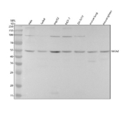 Western blot testing of human and mouse samples using the SEC62 antibody at 1:1000 dilution for 1 hour at room temperature. Predicted molecular weight ~50 kDa. A faint band at approximately 100 kDa is occasionally observed in tumor cell lines and may represent an SDS-resistant dimer or SEC62-containing complex rather than a distinct isoform.