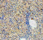 Immunohistochemical staining of NCR3 using anti-NCR3 antibody. NCR3 was detected in a paraffin-embedded section of human spleen tissue. Heat mediated antigen retrieval was performed in EDTA buffer (pH 8.0, epitope retrieval solution). The tissue section was blocked with 10% goat serum. The tissue section was then incubated with 2 ug/ml rabbit anti-NCR3 antibody overnight at 4oC. Peroxidase Conjugated Goat Anti-rabbit IgG was used as secondary antibody and incubated for 30 minutes at 37oC. The tissue section was developed using an HRP secondary and DAB substrate.
