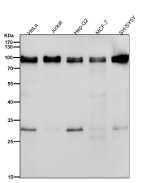 Western blot testing of human samples using the UBTF antibody at 1:1000 dilution for 1 hour at room temperature. A predominant band is detected at an approximately 89 kDa in all samples, consistent with full length UBTF. Lysates also show a weaker band near 30 kDa, which likely represents a proteolytic fragment of UBTF that retains the antibody epitope rather than a distinct isoform.