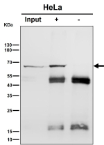 Immunoprecipitation analysis using the Hsp70 antibody at 1:50 dilution. Western blot at 1:1K dilution. The predicted molecular weight of Hsp70 is ~70 kDa and ~64 kDa (two isoforms).