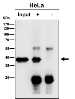Immunoprecipitation analysis using the antibody at 1:50 dilution. Western blot at 1:1000 dilution. Predicted molecular weight ~34 kDa. A band is detected at approximately 38-39 kDa in the IP lane, slightly above the predicted ~34 kDa size. This upward shift is consistent with altered migration of immunoprecipitated material, which often reflects partial complex retention or antibody related artifacts rather than a distinct isoform. The control IgG lane shows no corresponding band, confirming specificity of the immunoprecipitation.