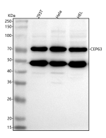 Western blot analysis of CEP63 using anti-CEP63 antibody. Lane 1: human 293T whole cell lysates, Lane 2: human Hela whole cell lysates, Lane 3: human HEL whole cell lysates. After electrophoresis, proteins were transferred to a nitrocellulose membrane at 150 mA for 50-90 minutes. Blocked the membrane with 5% non-fat milk/TBS for 1.5 hour at RT. The membrane was incubated with rabbit anti-CEP63 antibody at 0.5 ug/ml overnight at 4oC, then washed with TBS-0.1%Tween 3 times with 5 minutes each and probed with a goat anti-rabbit IgG-HRP secondary antibody at a dilution of 1:5000 for 1.5 hour at RT. The signal was developed using enhanced chemiluminescent. Strong bands are detected at approximately 70 kDa and 49 kDa, consistent with the major endogenous CEP63 isoform (617 aa, ~71 kDa) and a known smaller isoform or proteolytic fragment. The predicted ~81 kDa full-length isoform is weak or absent, a pattern commonly reported for CEP63 due to low abundance and centrosomal processing.