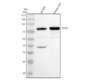 Western blot analysis of TGM7 using anti-TGM7 antibody. Electrophoresis was performed on a 10% SDS-PAGE gel at 80V (Stacking gel) / 120V (Resolving gel) for 2 hours. Lane 1: rat liver tissue lysates Lane 2: mouse liver tissue lysates. After electrophoresis, proteins were transferred to a nitrocellulose membrane at 150 mA for 50-90 minutes. Blocked the membrane with 5% non-fat milk/TBS for 1.5 hour at RT. The membrane was incubated with rabbit anti-TGM7 antibody at 0.5 ug/ml overnight at 4oC, then washed with TBS-0.1%Tween 3 times with 5 minutes each and probed with a goat anti-rabbit IgG-HRP secondary antibody at a dilution of 1:5000 for 1.5 hour at RT. The signal was developed using an ECL Plus Western Blotting Substrate. The expected molecular weight of TGM7 is ~75-80 kDa.