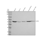 Western blot analysis of GCNT2 using anti-GCNT2 antibody. Electrophoresis was performed on a 10% SDS-PAGE gel at 80V (Stacking gel) / 120V (Resolving gel) for 2 hours. Lane 1: human HepG2 whole cell lysates, Lane 2: human Caco-2 whole cell lysates, Lane 3: rat kidney tissue lysates, Lane 4: mouse kidney tissue lysates, Lane 5: mouse lung tissue lysates. After electrophoresis, proteins were transferred to a nitrocellulose membrane at 150 mA for 50-90 minutes. Blocked the membrane with 5% non-fat milk/TBS for 1.5 hour at RT. The membrane was incubated with rabbit anti-GCNT2 antibody at 0.5 ug/ml overnight at 4oC, then washed with TBS-0.1%Tween 3 times with 5 minutes each and probed with a goat anti-rabbit IgG-HRP secondary antibody at a dilution of 1:5000 for 1.5 hour at RT. The signal was developed using an ECL Plus Western Blotting Substrate. A predominant band is detected at approximately 40 kDa in all samples, running below the predicted ~46 kDa size but consistent with the known apparent molecular weight of the Golgi glycosyltransferase GCNT2.