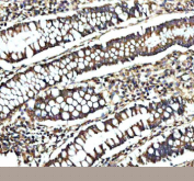 Immunohistochemical staining of GCNT2 using anti-GCNT2 antibody. GCNT2 was detected in a paraffin-embedded section of human colon tissue. Heat mediated antigen retrieval was performed in EDTA buffer (pH 8.0, epitope retrieval solution). The tissue section was blocked with 10% goat serum. The tissue section was then incubated with 2 ug/ml rabbit anti-GCNT2 antibody overnight at 4oC. Peroxidase Conjugated Goat Anti-rabbit IgG was used as secondary antibody and incubated for 30 minutes at 37oC. The tissue section was developed using an HRP secondary and DAB substrate.