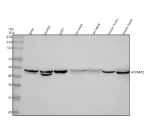 Western blot analysis of Renin receptor/ATP6AP2 using anti-Renin receptor antibody. Lane 1: human SiHa whole cell lysates, Lane 2: human HUVEC whole cell lysates, Lane 3: human U251 whole cell lysates, Lane 4: rat brain tissue lysates, Lane 5: rat heart tissue lysates, Lane 6: mouse brain tissue lysates, Lane 7: mouse heart tissue lysates. After electrophoresis, proteins were transferred to a nitrocellulose membrane at 150 mA for 50-90 minutes. Blocked the membrane with 5% non-fat milk/TBS for 1.5 hour at RT. The membrane was incubated with rabbit anti-Renin receptor antibody at 0.5 ug/ml overnight at 4oC, then washed with TBS-0.1%Tween 3 times with 5 minutes each and probed with a goat anti-rabbit IgG-HRP secondary antibody at a dilution of 1:5000 for 1.5 hour at RT. The signal was developed using enhanced chemiluminescent. A predominant band is detected at approximately 45-50 kDa in all samples, running above the predicted ~39 kDa mass but consistent with the apparent molecular weight of the heavily glycosylated full length receptor. Doublets likely reflect distinct glycosylation or processing states of ATP6AP2.